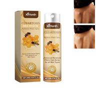 1/2/3 spray per acne posteriore, rimozione dell'acne del corpo, spray per la pulizia di schiena, collo, vita, acne e ridurre l'infiammazione (1 pz)