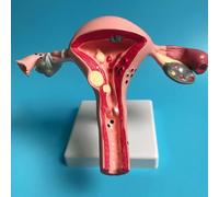 1 pz Modello di ovaio uterino patologico umano Sezione trasversale Struttura Modello Anatomico Anatomia Organo Femminile Insegnamento Strumento di Studio