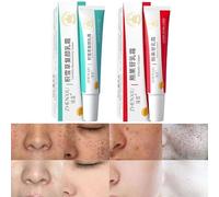 1 set Dark Spot Correcting Glow Siero 30 ml + 30 ml, siero facciale, macchie scure, siero correttivo, brightens & idratanti, trattamento iperpigmentazione