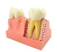 10 Modello di Anatomia di insegnamento Dentale Modello di Studio Modello di insegnamento 4X Modello di decomposizione dei Denti Modello di dimostrazione dei Denti per l'educazione del paziente