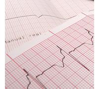 10 PACCHI DI CARTA TERMICA PER ECG SCHILLER AT-10 PLUS, AT-110 e AT-2 PLUS / 210mm X 140mm X 160 Fogli