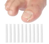 10 strisce di correzione dell'unghia del piede incarnite, kit di correttori per unghie incarnite, strisce raddrizzatrici per unghie dei piedi per recuperare le unghie dei piedi spesse strumento per