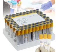 100 Provette Per La Raccolta Del Sangue Sottovuoto, Provette Monouso In Vetro Da 3 Ml/5 Ml/10 Ml, Provetta Per Gel Di Separazione + Coagulante, Per La Separazione Del Siero,Preparazione Del Prp,5ml