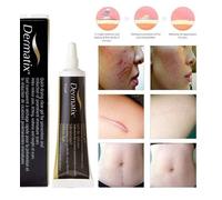 15g DERMATIX Crema Gel in silicone per Trattamento Cicatrici operazione 15gr