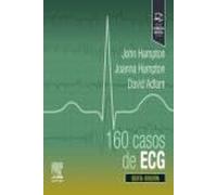 160 casos de ECG
