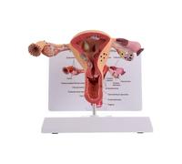 1Pc Female Reproductive Organs Anatomy Model Uterus Model For