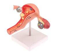 1Pc Modello di oggetti di scena medici Modello anatomico patologico dell'utero dell'ovaio Strumento di studio della sezione trasversale dell'anatomia