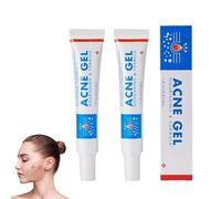 2 pezzi Acne Control Cream, crema anti brufoli Acne Gel Fast Assorbe Blemishes & Breakouts corpo acne crema antiimpurità gel riduce punti neri acne, perfeziona l'aspetto della pelle