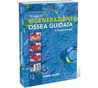 20 anni di rigenerazione ossea guidata in implantologia