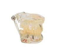 2025 Latest Model Dental Implant Model Transparent Clear Display Pathological ...