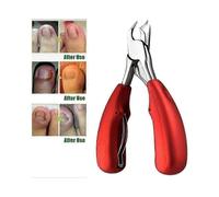 2025 newProfessional Ingrown Toenail Clipper - Thick Nail Precision Straight Blade Tool