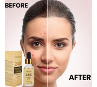 24K Oro Siero Ammuri Meglio Della Charlotte Tilbury Magico Cristallo Elixir