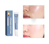 2PCS Azelaic Acid Cream, 14% Azelaic Acid Acne Cream - Dark Spot Remover, Face Skin and Beauty Care Enhanced Formula for Brighter, Healthier Skin Care