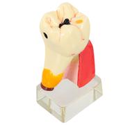 2Pz Modello Dente Decaduto in Resina Beige Per Insegnamento