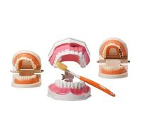 3 Pezzi di Modello di Denti Normali e Carie, Modello di insegnamento per la spazzolatura dei Denti per Bambini e Ragazzi, Color Carne, 12 cm,Flesh-12cm