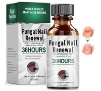 30ml Liquido Cura delle unghie,Soluzione per la Cura Delle Unghie,Rinforza la Struttura Dell'unghia,Cura per Unghie delle piedi,adatto Per Dell'unghia Fragili