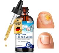 30ml Liquido Riparatore Cura delle unghie, Oli per la cura unghie incarnite, Smalto Curativo, Facile e Rapido, Senza Scolorire l'Unghia