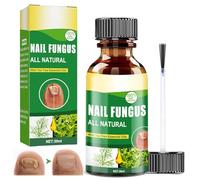 30ML Liquido Riparatore Cura delle unghie,Rinforza la Struttura Dell'Unghia,Soluzione per la Cura Delle nail,Migliora l'aspetto dell'unghia,Unghie Gialle e Danneggiate