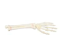 3B Scientific 1018337 Orthobone mano sinistra e avambraccio Bone Model