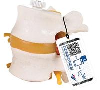 2 vertebre lombari con ernia del disco 3B Scientific, montaggio elastico A76/9