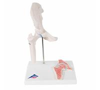 3B Scientific A84/1 Mini Articolazione dell'Anca con Sezione Trasversale + software gratuito di anatomia - 3B Smart Anatomy