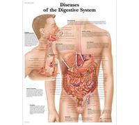 3B Scientific - Carta Laminata delle Malattie del Sistema Digerente - Poster di Patologia Protetto da UV e Polvere per Studio, Insegnamento & Cliniche