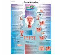 3B Scientific Contraccezione Tavola Didattica Anatomica su Carta Laminata, Multicolore, 50 x 67 cm