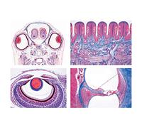 3B Scientific GmbH W13302 Serie III. Organi del Senso -