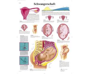 3B Scientific kawe lavagna gravidanza, 1