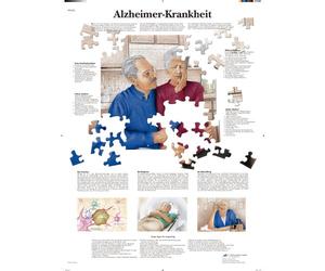 3B Scientific kawe lavagna malattia di Alzheimer, 1