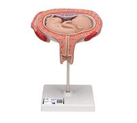 3B Scientific L10/6 Feto, 5. Mese, Presentazione di Spalla + software gratuito di anatomia - 3B Smart Anatomy