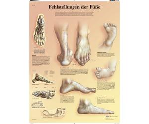 3B Scientific Lehr lavagna - scorretto della mascella dei piedi, 1