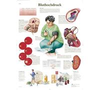 3B Scientific lehrtafek ipertensione, 1