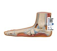 3B Scientific M31 Piede Piatto, Pes Planus + software gratuito di anatomia - 3B Smart Anatomy
