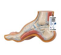 3B Scientific M32 Piede Cavo, Pes Cavus + software gratuito di anatomia - 3B Smart Anatomy
