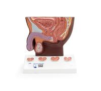 3B Scientific Modello di Prostata, Grandezza Naturale, Pelle Scura, 3B Smart Anatomy