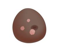 3B Scientific® Modello Mammario Sonotrain con Cisti - Pelle Scura, Simulatore mammario a ultrasuoni per rilevamento di cisti e formazione diagnostica