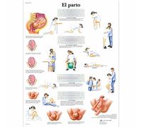 3B Scientific Stampato in Carta, Parto, 1