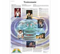 3B Scientific Tossicodipendenza Tavola Didattica Anatomica su Carta Laminata, Multicolore, 50 x 67 cm