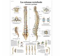3B Scientific, tavola anatomica, La colonna vertebrale, anatomia e patologia (co