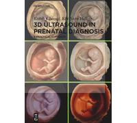 Rabih Chaoui Kai-Sven Heli 3D Ultrasound in Prenatal Diagnos (Copertina rigida)