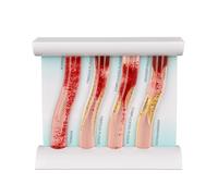4 Pezzi Modello Anatomico di Arteria Umana per l'Insegnamento Comparativo | Modello Vascolare Simulato per Arteriosclerosi e Studio di Circolazione in Anatomia e Fisiologia
