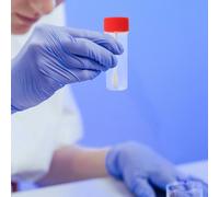 50 Pcs Contenitore Esami Feci Contenitori Per Campioni Campione Di Pipì