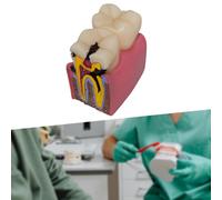 6 volte la dimostrazione del modello di decadimento della decadimento del dente
