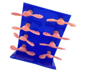 8 tipi modello anatomico utero malato Modello utero in PVC per studenti medicina e per studiare le condizioni ginecologiche Dimostrazione malattia uterina