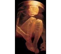 9299614 Audio Cd Alice In Chains - Nothing Safe - The Best Of The Box