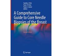 A Comprehensive Guide to Core Needle Biopsies of the Breast