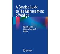 A Concise Guide to Management of Vitiligo