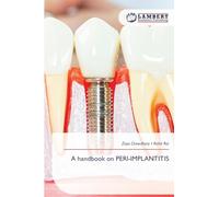 A handbook on PERI-IMPLANTITIS