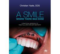 A smile where there was none. A pratical approach to fixed full-arch impla...